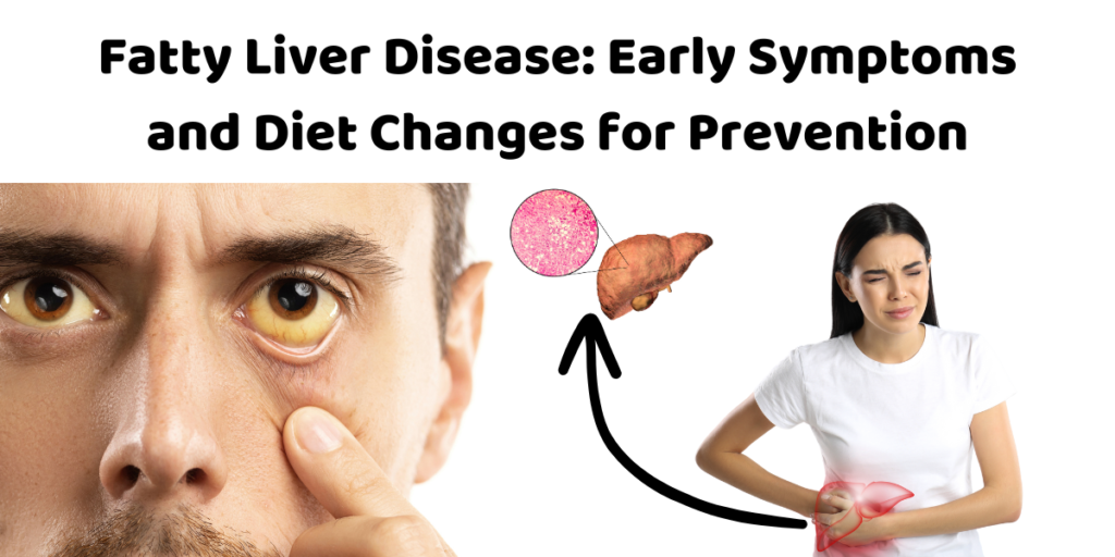 Early Signs and symptoms for Fatty Liver